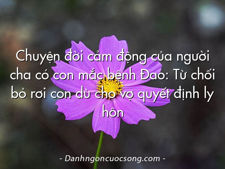 Chuyện đời cảm động của người cha có con mắc bệnh Đao: Từ chối bỏ rơi con dù cho vợ quyết định ly hôn